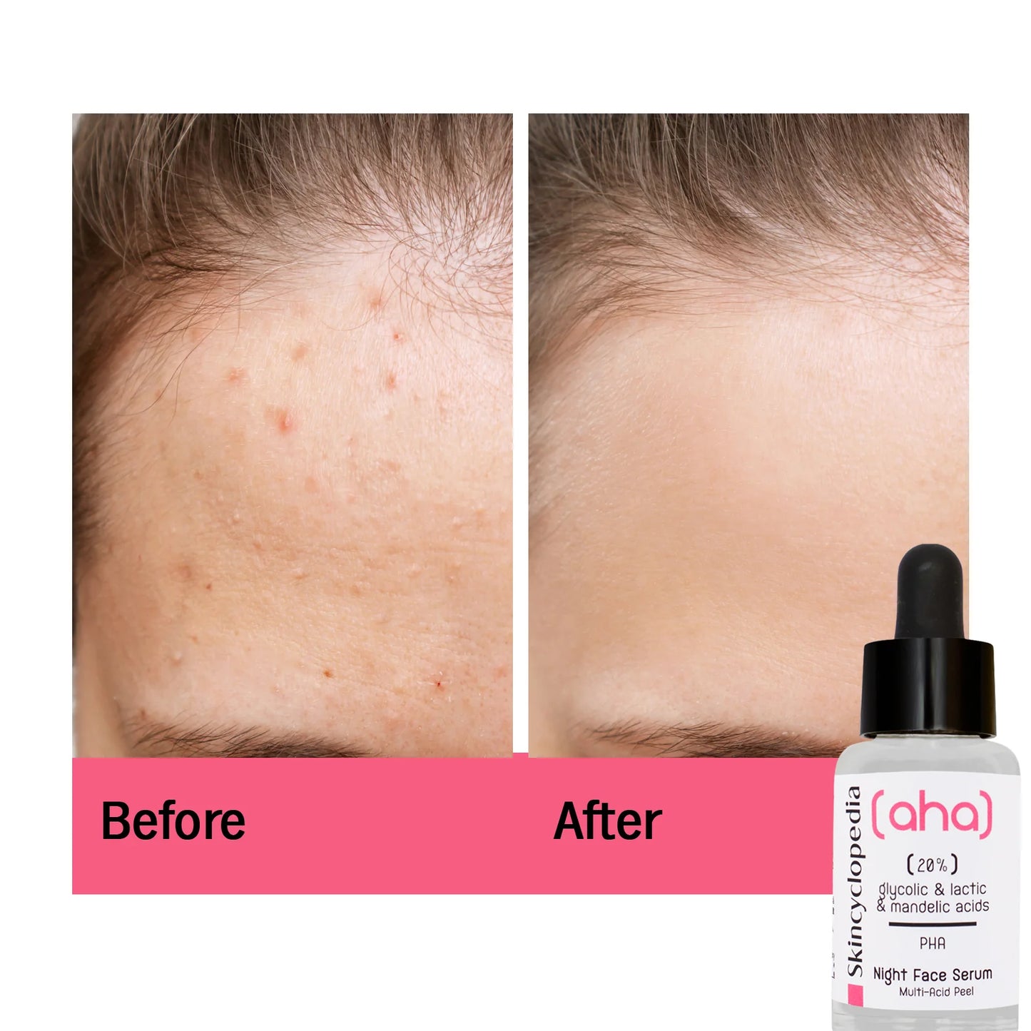 סרום פילינג לילה לעור הפנים 30 מ״ל Night Serum
