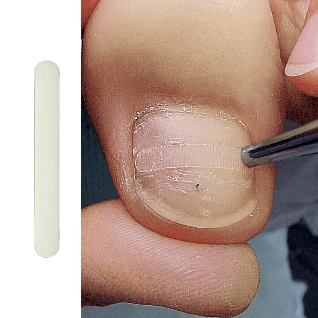 Universal handle - ידית אוניברסלית להדבקת רצועות תיקון