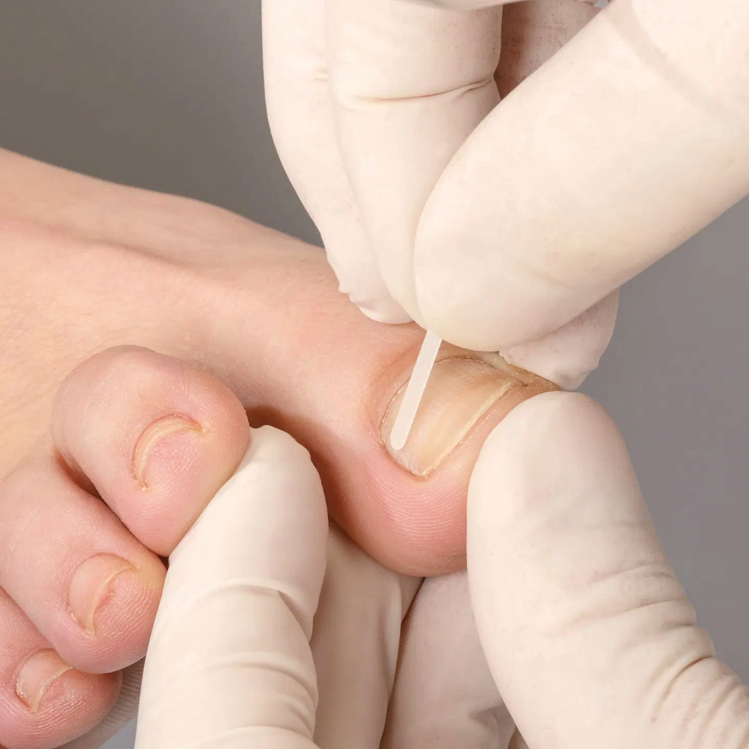 Professional Gel Glue - ג'ל מקצועי להדבקת מערכות תיקון לציפורניים