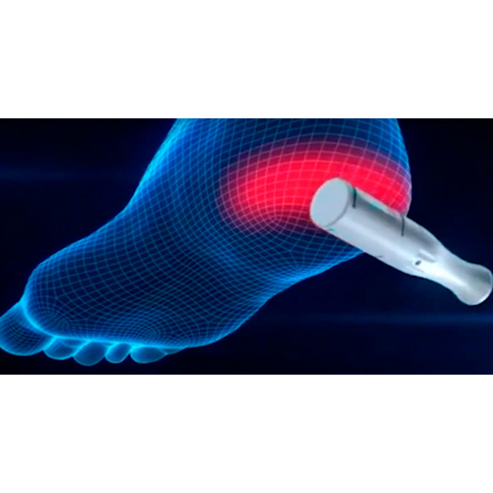 NSK OMNICUT - מכשיר טיפולי להסרת יבלות ועיבוי עור בכף הרגל
