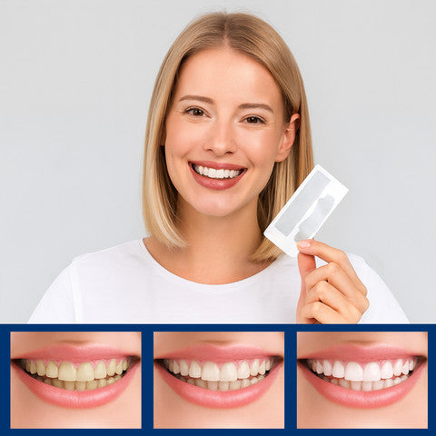 White Pro Whitening Strips - רצועות להלבנת שיניים 28 יחידות