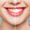 White Pro Whitening Strips - רצועות להלבנת שיניים 28 יחידות