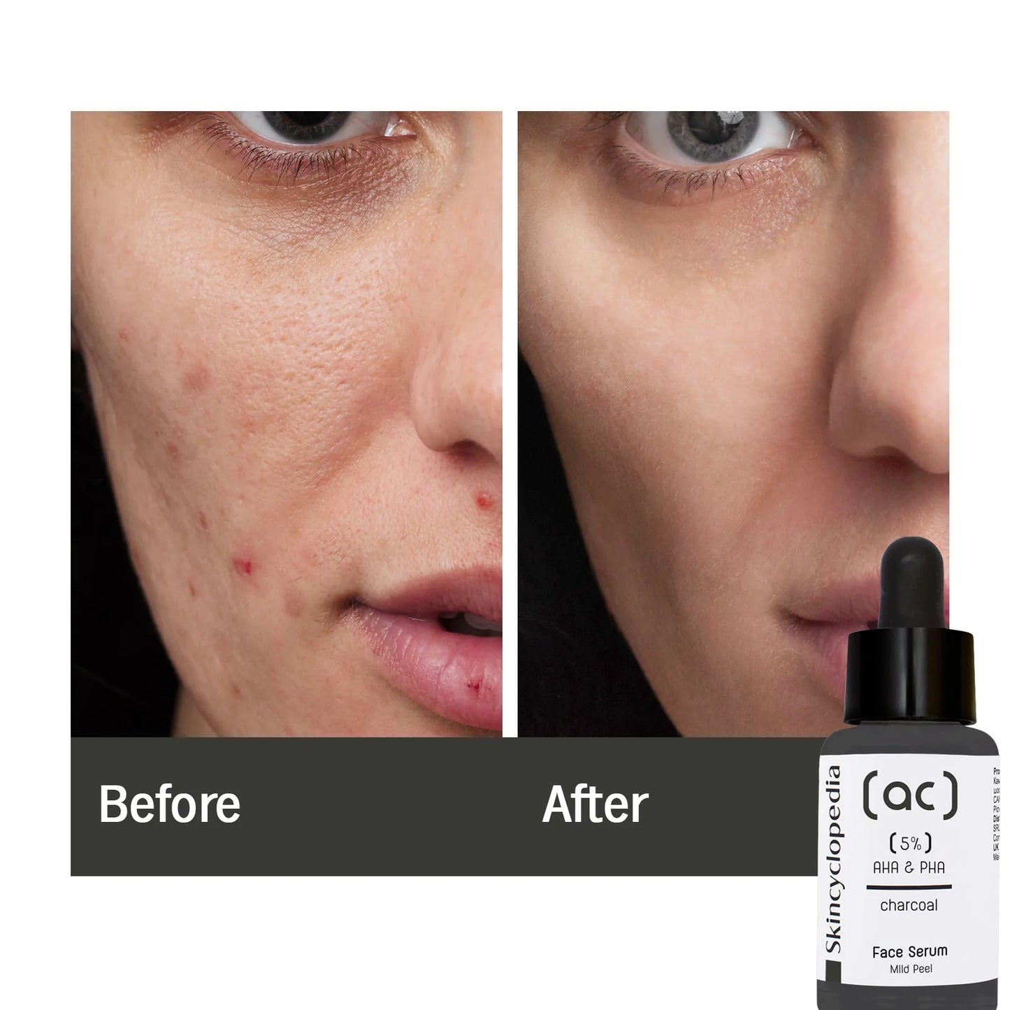 סרום פילינג עדין לפנים בתוספת פחם פעיל 30 מ״ל Mild Peeling Face