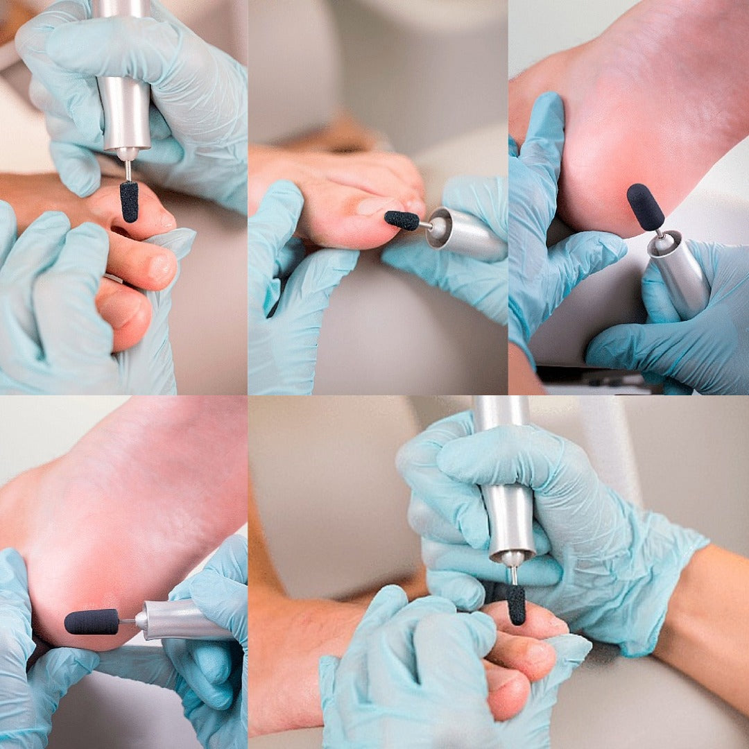 Disposable sander set -סט מנדרל ומשייפים חד־פעמיים 160 יח׳