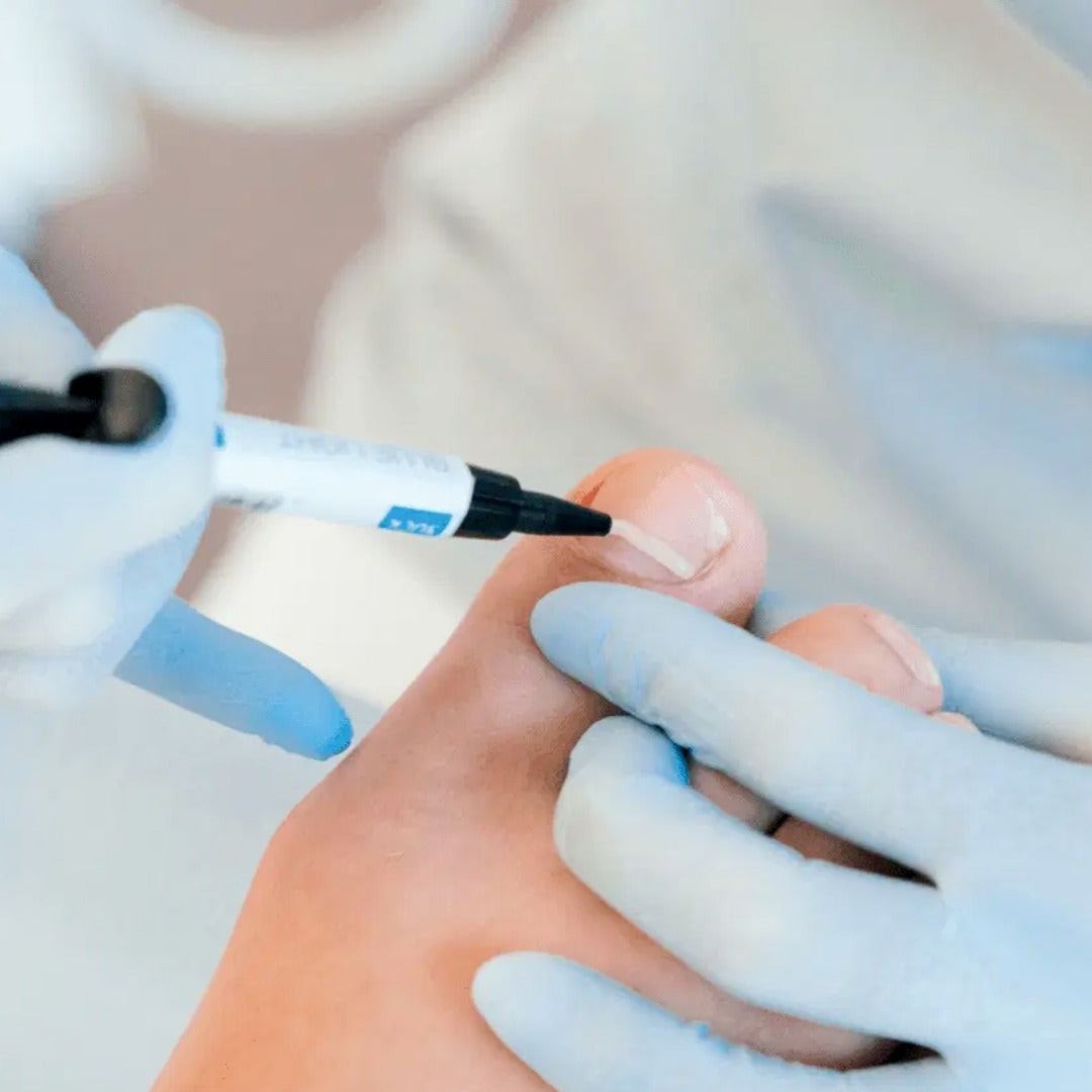 Blue Light Professional Starter-Set - סט התחלתי מקצועי לאורטונקסיה