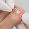 PodoFix® Complete Kit -  ערכת אורטוניקסיה מקצועית מתקדמת