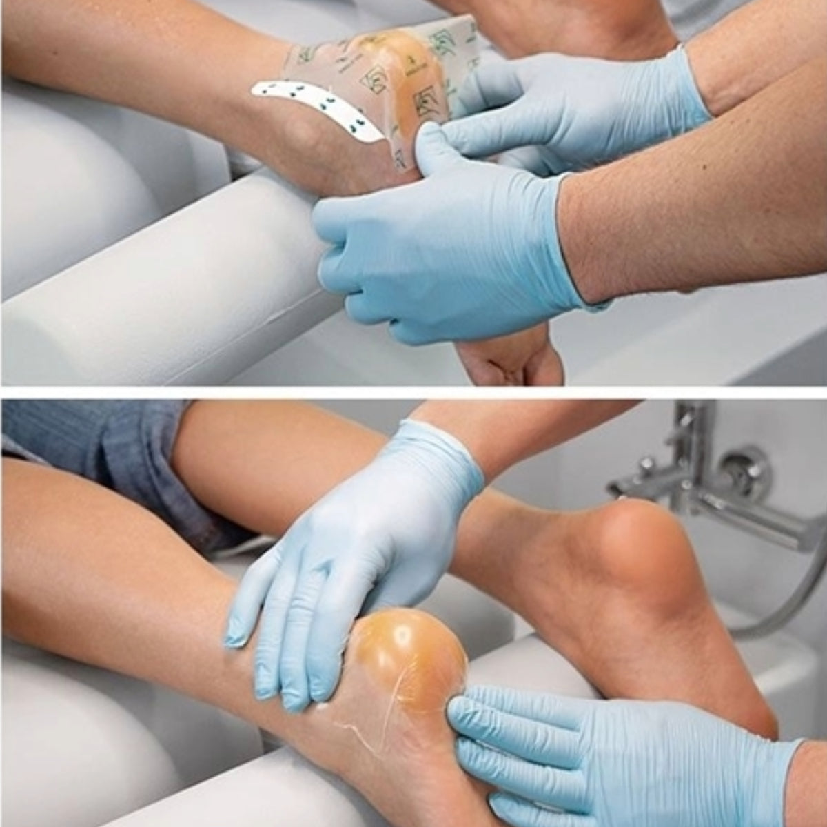 Occlusive plaster - פלסטר אוקלוסיבי