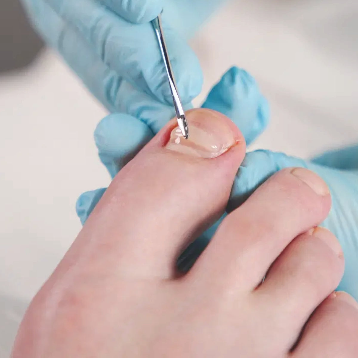 Nail Correction Mass - ג'ל גמיש לעיצוב וחיזוק ציפורניים