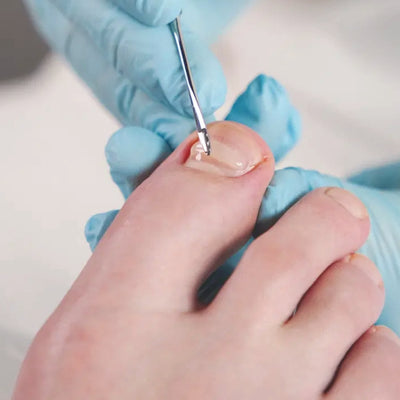 Nail Correction Mass - ג'ל גמיש לעיצוב וחיזוק ציפורניים
