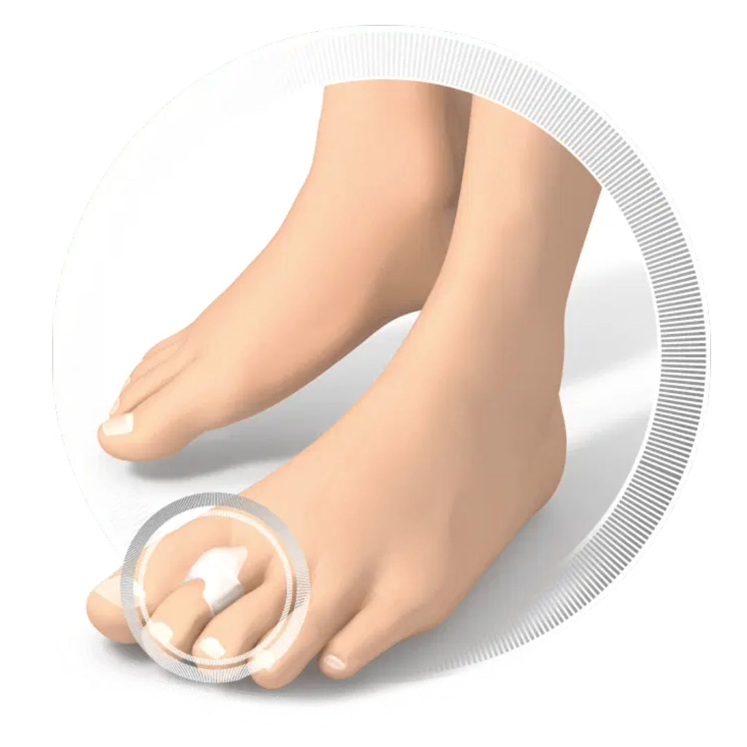 Protective Padding Ring - טבעת הגנה סיליקונית ליבלות