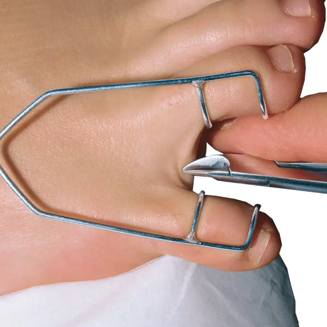 Toe separators - מפריד אצבעות