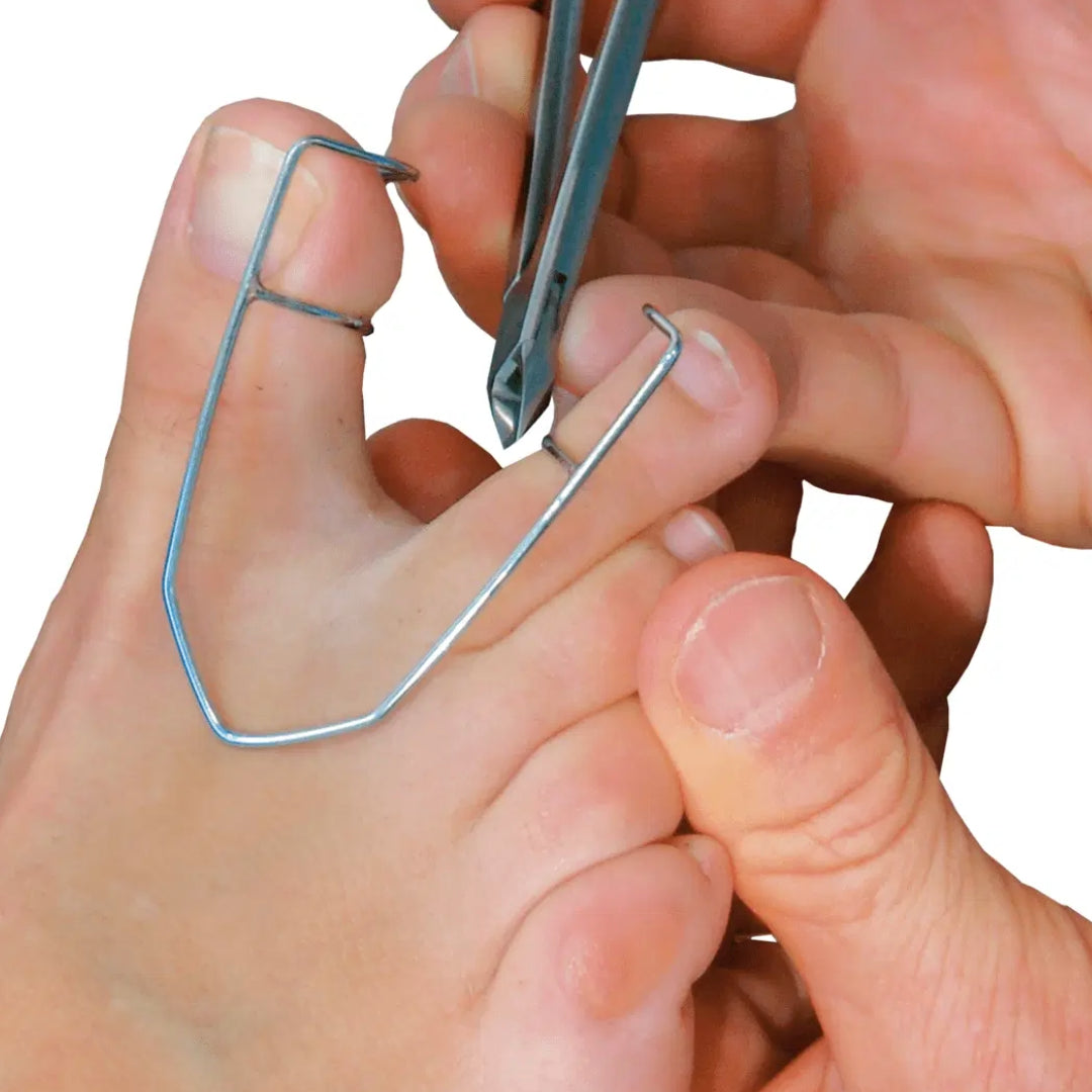 Toe separators - מפריד אצבעות