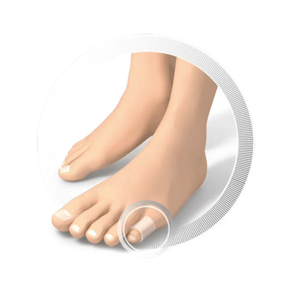 Toe Separators - מפרידי אצבעות