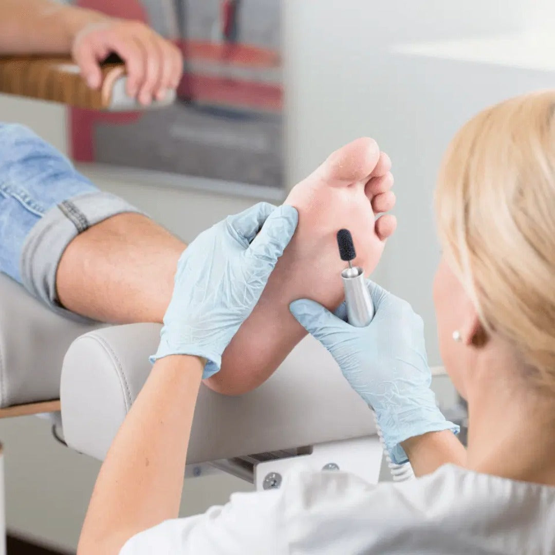 RUCK Sanding Caps - משייפים חד-פעמיים קורונדום Ø11 מ"מ 10יח